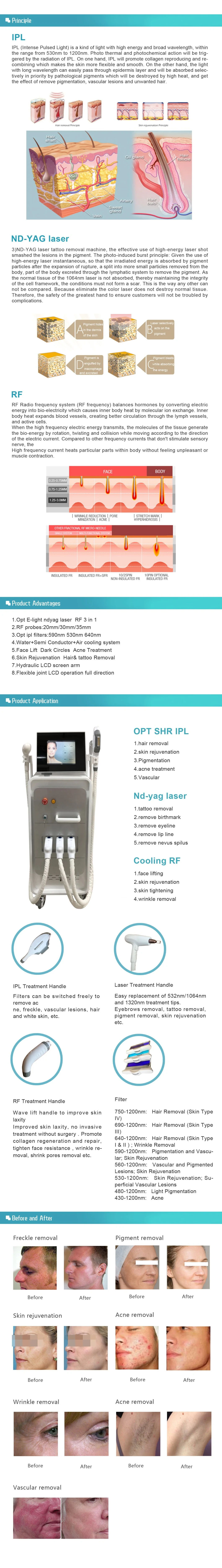 Multi-Function IPL/Opt + ND YAG Laser + RF, 3 in 1 Beauty Instrument