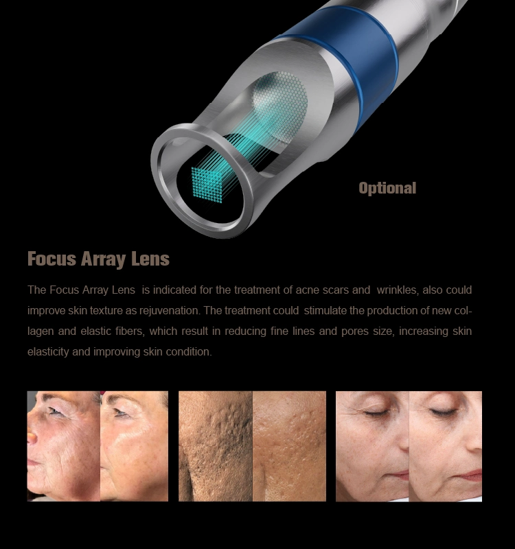 Laser Freckle Removal Permanent Adm Pigmentation Therapy Ce ND YAG Picosecond Laser Machine