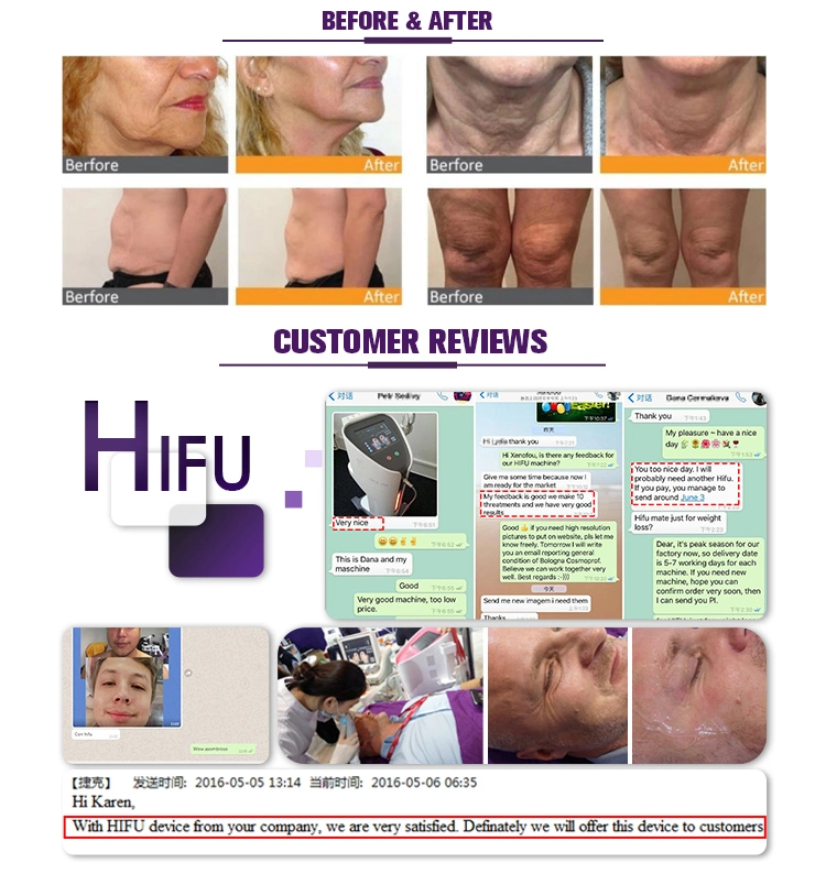 Promotion Price 3D Hifu Anti-Wrinkle Removal Hifu Face Lifting Machine