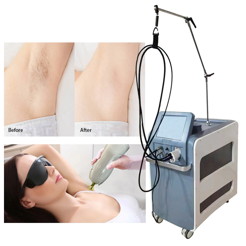 2022 New High Power Medical CE Laser Hair Removal Alexandrite Long Pulse ND YAG 1064/755nm Professional Hair Remover Machine